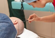 השתלת שיער בגבות – פתרון אסתטי מושלם