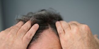 פתרונות חדשניים לנשירת שיער